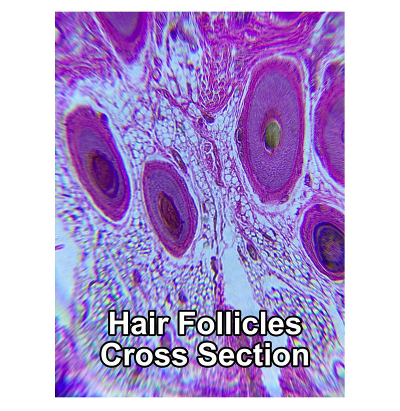 A microscopic image of a hair follicle cross-section. It is purple with four large circles and the appearance of webbing around it.