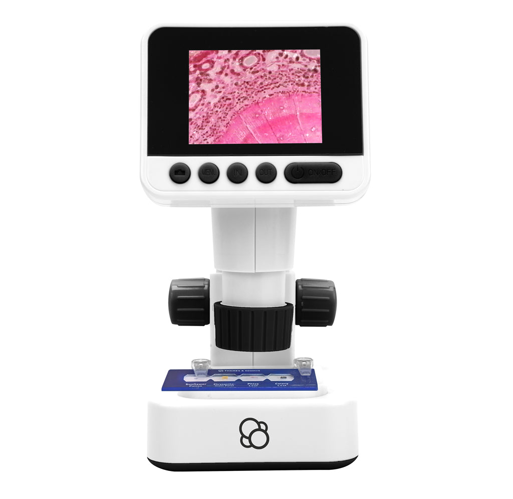 A white microscope facing forward showing a pink image of a cell on its digital screen. 