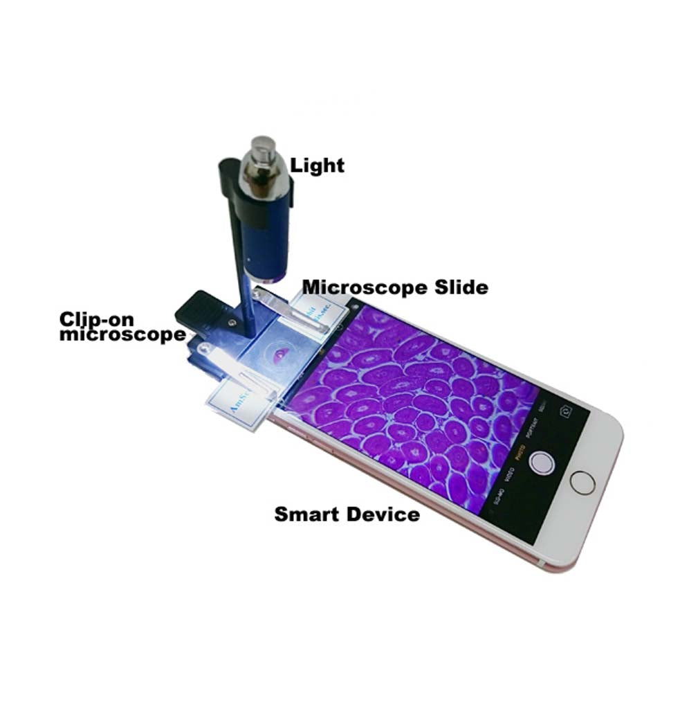 The clip-on microscope is attached to the front of a smart device with a slide containing a hair follicle cell.